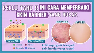 Perlu Tahu! Ini Cara Memperbaiki Skin Barrier Yang Rusak