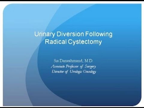 Surgery and Urinary Reconstruction for Muscle-Invasive Bladder Cancer - Daneshmand - LA