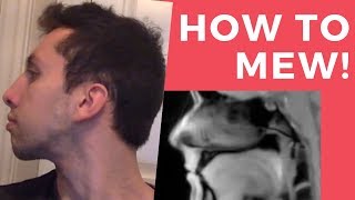 COMPLETE GUIDE on How to Mew (Perfect your Tongue Posture!)