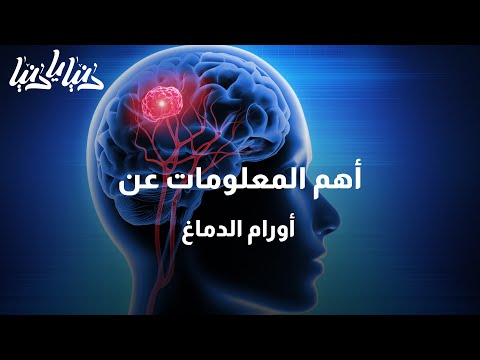 أهم المعلومات عن أورام الدماغ دنيا يا دنيا أورام الدماغ