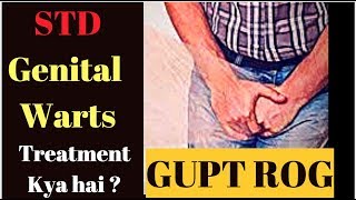 गुप्त रोग इलाज Genital Warts गुप्तंगी मस्से ilaj Treatment by Dr Rupal #STD Veneral Disease (2019)