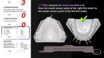 CC361. Discrepancy Index (DI) Part 3