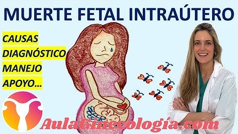 MUERTE FETAL INTRAÚTERO, CAUSAS, DIAGNÓSTICO, MANEJO, APOYO... - Ginecología y Obstetricia -