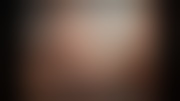 Anatomical laparoscopic S2 liver resection