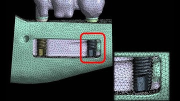 Pesquisa com o método de elementos finitos na odontologia.
