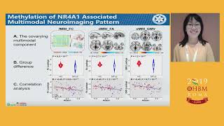 OHBM 2019 | Oral Sessions | NR4A1 Associated Multimodal Neuroimaging Patterns Impaired in Mesi…