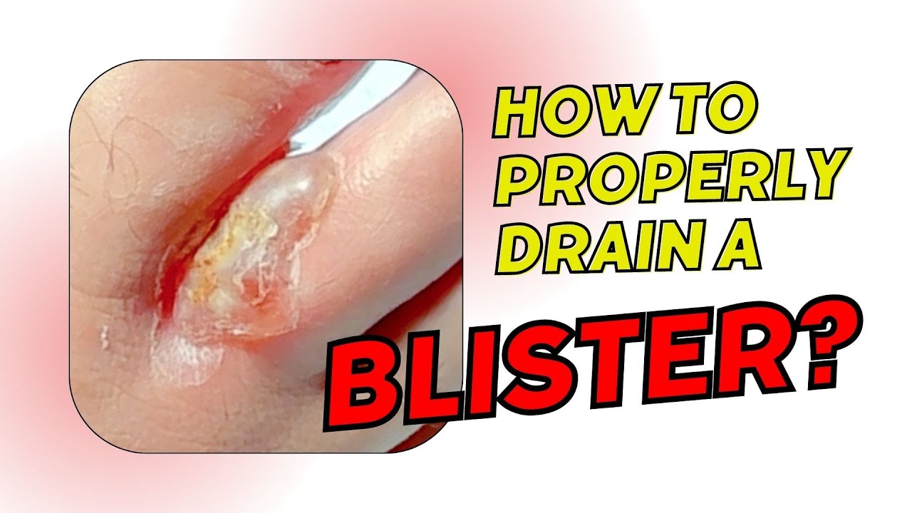 how-to-properly-drain-a-blister-youtube