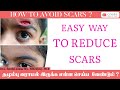 How to reduce scar ?  After injury or surgery in Tamil | தழும்பை  வராமல் இருக்க எளிய வழி |
