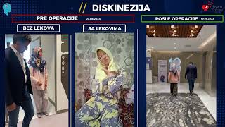 Uhvaćena između dva simptoma: kako je DBS prekinuo ciklus Parkinsonove bolesti i diskinezije