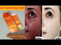 Vicco Turmeric Skin Cream Full Review in Hindi | क्या ये क्रीम फेस को गोरा करती है | Get Whiten skin