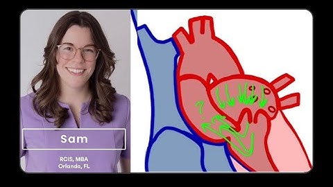 Cardiac Output and Atrial Fibrillation (Afib)