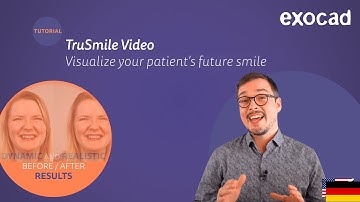 TruSmile Video / dynamische Visualisierung im Smile Creator / exocad cloud AI (Tutorial in German)