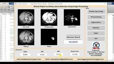 Kidney Stone Analysis Using Image Processing