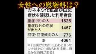 カネボウ自主回収　被害者４０００人超え！返金と慰謝料は？精神的苦痛は？