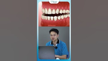 Khớp Cắn Ngược Là Gì | Nha Khoa Minh Châu