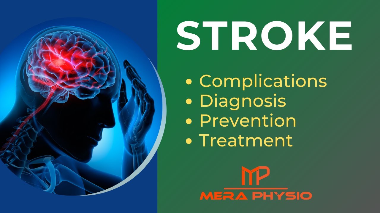 Stroke | Complications, Diagnosis, Prevention, Treatment of Stroke | In ...