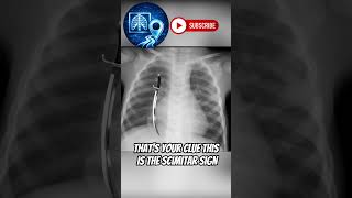 The Curved Line Nobody Expects #medical #xray