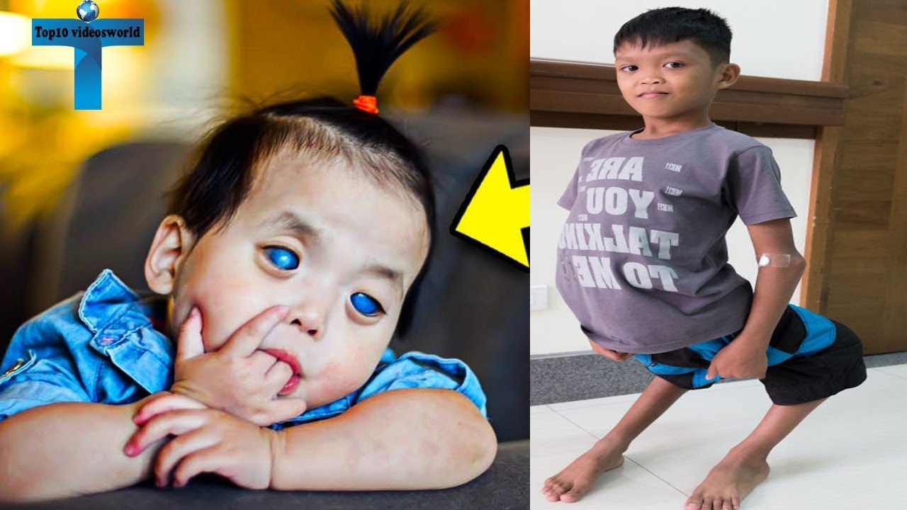 Top 10 Unusual And Amazing Kids Around The World You Won't Believe Exist -  YouTube