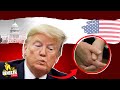 Did Donald Trump Have a Stroke? Face Droop at 9/11 Memorial Explained