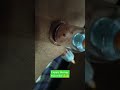 knee pain Cupping therapy | ghutne ke dard me aram | #kneepain #cuppingtherapy #shortsfeed