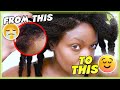 How to restore thinning edges (Part 2/2) | NATURAL HAIR