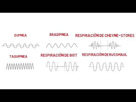 Patrones respiratorios (Eupnea, Bradipnea, Taquipnea, Biot, Cheyne-Stokes y Kussmaul)