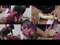 कमर दर्द | साइटिका | slip Disc का इलाज chiropractic द्वारा | डॉ फैजान आलम Chiropractor भागलपुर