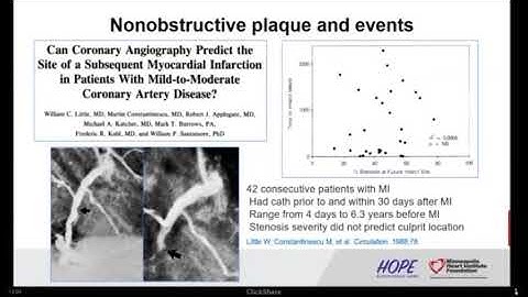 Victor Cheng, MD | CT Imaging of Coronary Artery Plaque: Substrate-based Approach to CAD