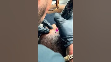 Scalp Micropigmentation Density work