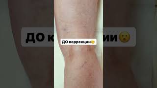 УБРАТЬ СЕТОЧКИ🕸️🕸️🕸️
