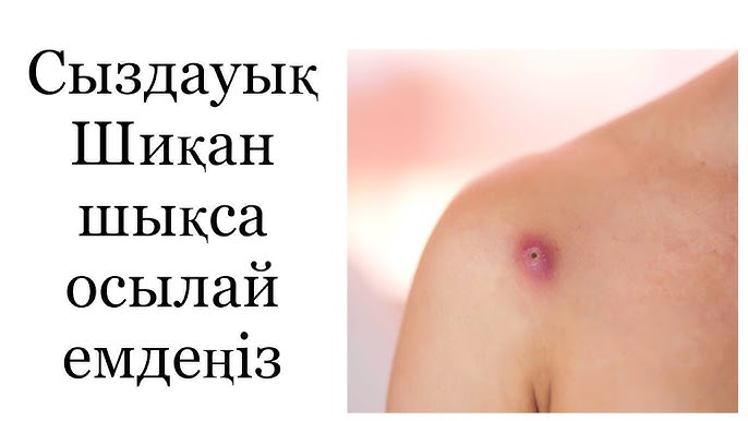 порно жопа ит стилі