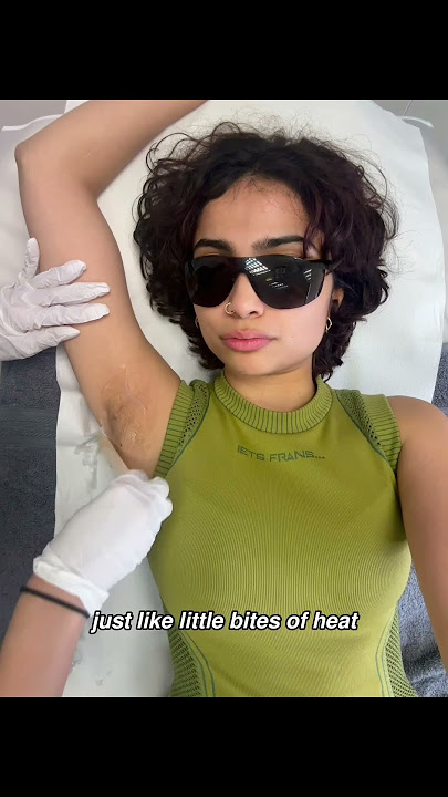 painless laser hair removal exists?