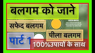 बलगम के रंग से जाने बिमारी 100%उपायों के साथ सफेद बलगम पीला बलगम का जड़ से खात्मा