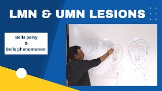 LMN & UMN Lesions Made Easy || How to differentiate LMN & UMN lesions