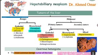 L7: Hepatobilliary Neoplasm Patho GIT Crash course
