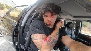 The WORST BMX Crash of my Entire Life. Here's what happened..
