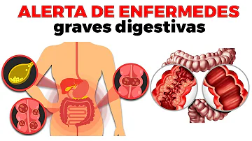 ¿Cuáles son las 3 principales enfermedades digestivas?