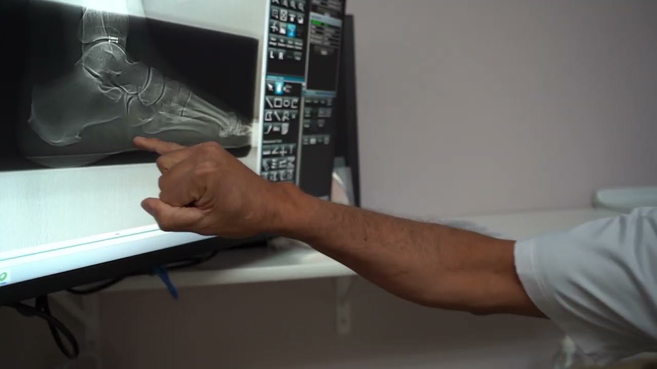 DON'T SUFFER FROM PLANTAR FASCIITIS ANY LONGER.  $79 TRIAL TREATMENT & MAPPING SESSION. CALL 928-778-7996 FOR DETAILS. EXPIRES SEPT 30, 2025