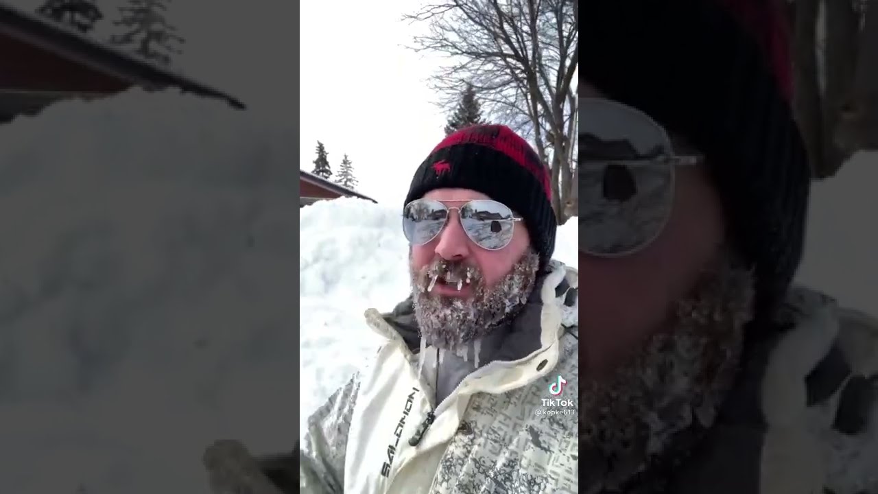 This So True Shorts Funny Tiktok Credit Kopke613