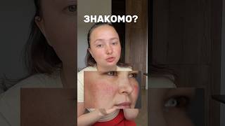 СМОТРЕТЬ ВСЕМ!  сыворотка для чувствительной кожи WW134543 озон: 2438035334