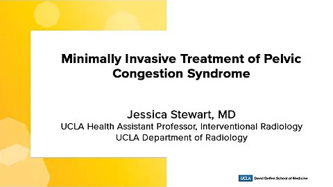 Minimally Invasive Treatment of Pelvic Congestion Syndrome - DayDayNews