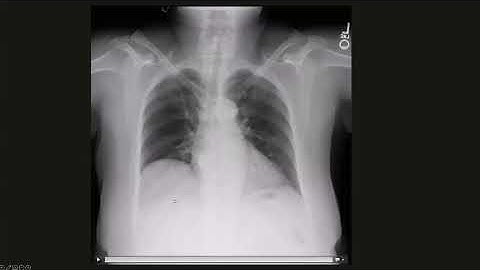 Clinical Applications of Dynamic Digital Radiography in Thoracic and Musculoskeletal Imaging Video