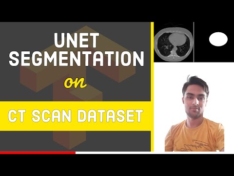 UNET Segmentation on CT Scan Images using TensorFlow 2.0 | Image Segmentation | Deep Learning