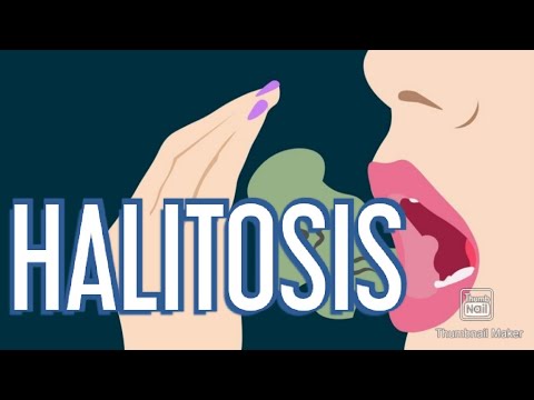 HALITOSIS (bau mulut), definisi halitosis, gejala atau tanda halitosis, penyebab halitosis, terapi