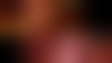 15 308GS ICG Fluorescence Imaging: Your Best Friend in Difficult Robotic Cholecystectomy