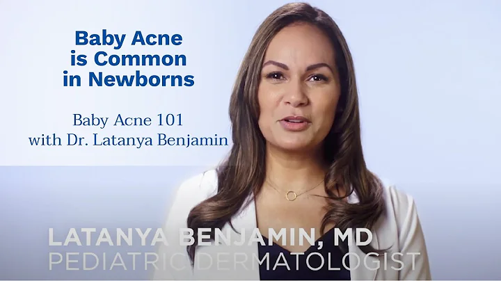 Baby Acne 101 with Dr. Latanya Benjamin