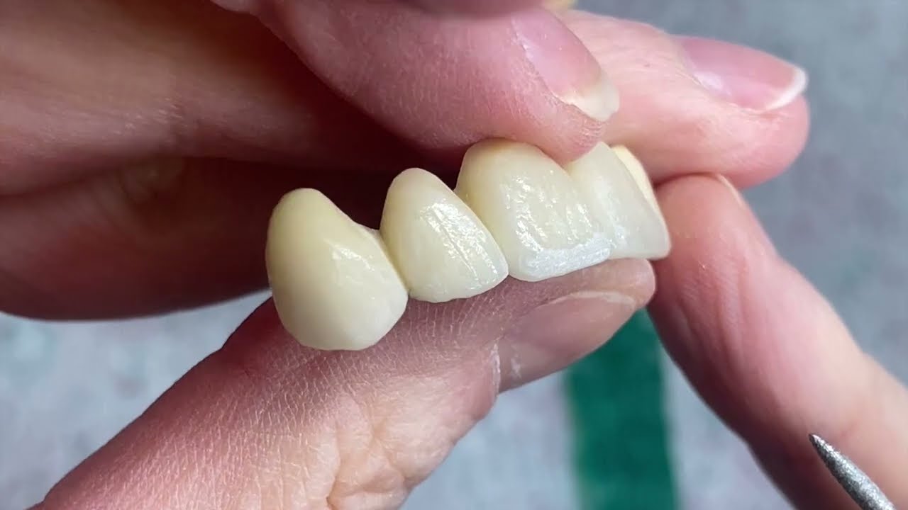 Как создать текстуру на переднем мосту