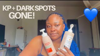 AVIEN 5.5 Body Care Routine for Hyperpigmentation, KP & Glowing Skin ✨