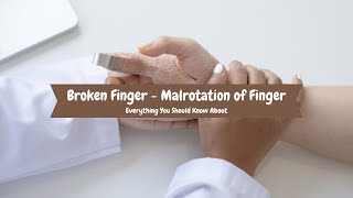 Broken Finger - Malrotation Of Finger Illness Insights
