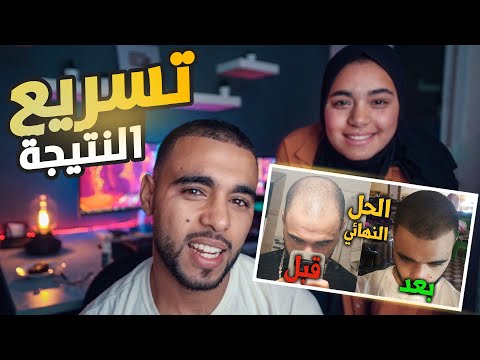 كيفاش توضع المينوكسديل بالطريقة الصحيحة العلاج الوحيد لتساقط الشعر و إنبات اللحية